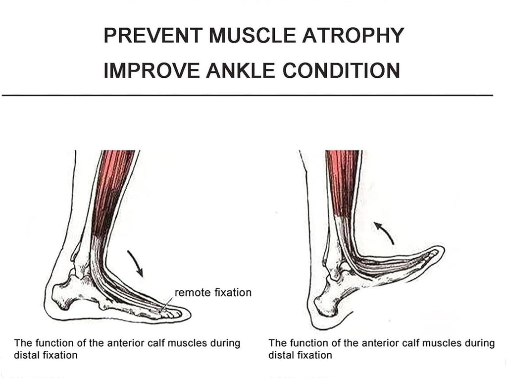 Ankle Joint Rehab Training Equipment,Ankle Post-Operative Trainer,Foot Rehabilitation Training Equipment,Static Stretch Correction Electric