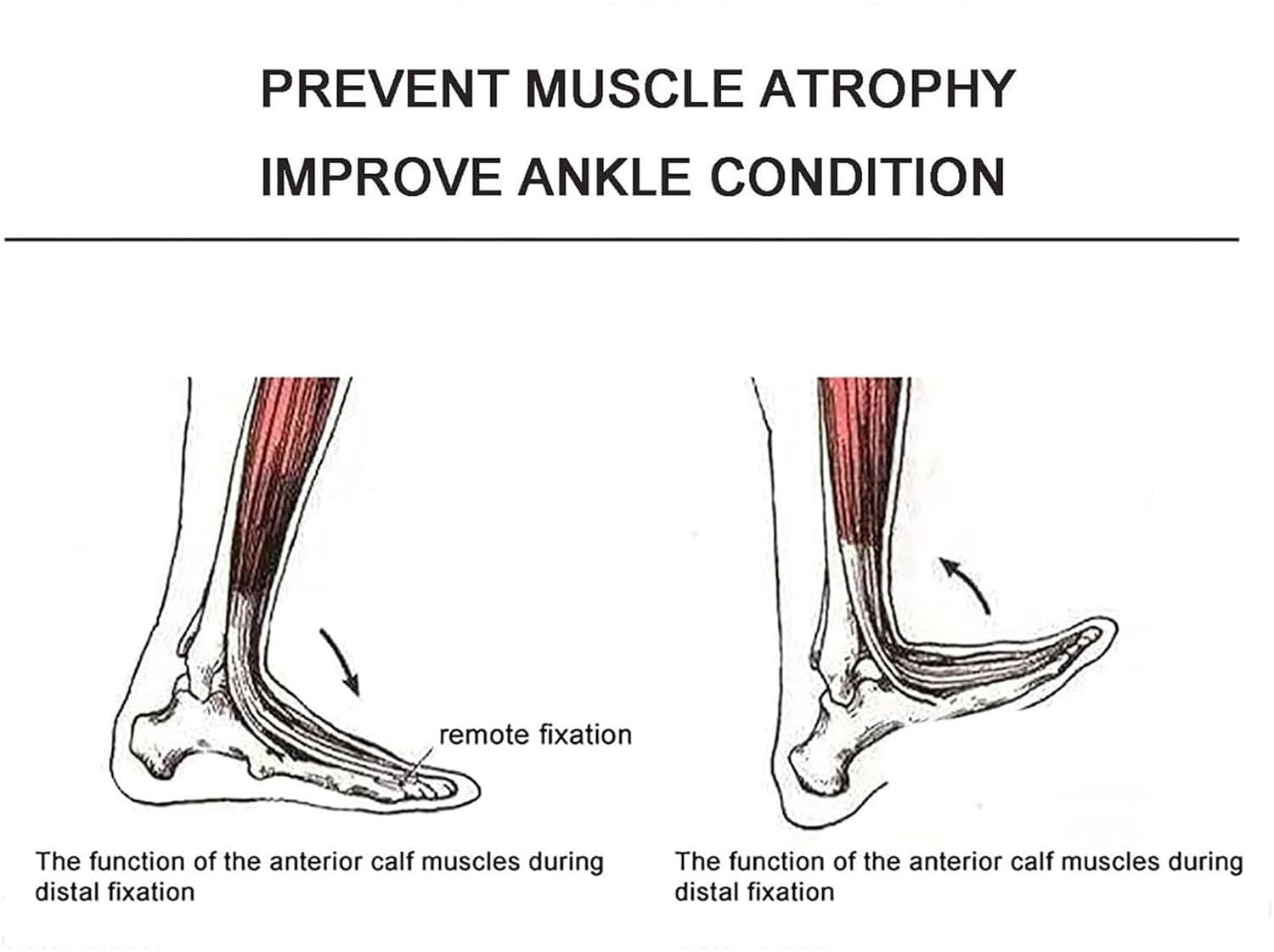 Oiyeknrd Ankle Joint Rehab Training Equipment,Ankle Joint Stretching Exerciser,Ankle Post-Operative Trainer,Angle/Strength Adjustable,for Reducing Pain/Ankle Sprain Manual